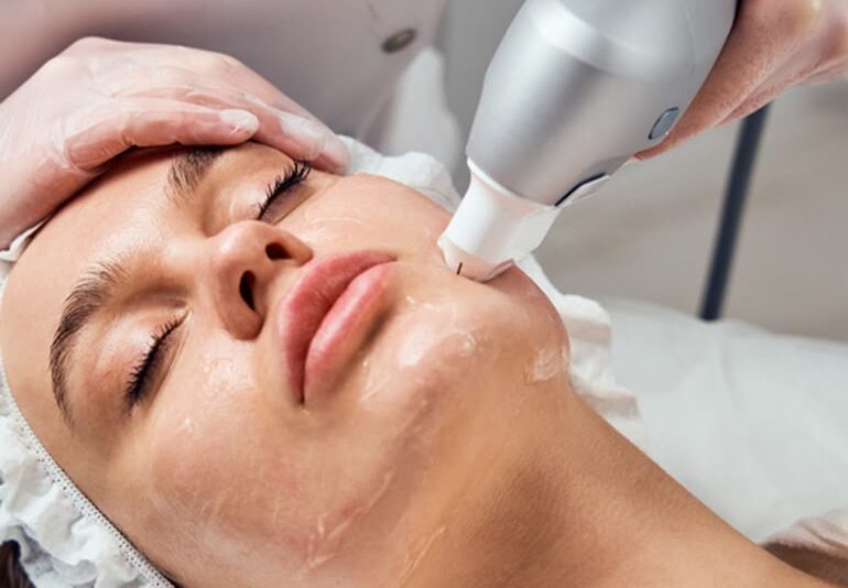 Ultraformer: Lifting Facial e Corporal Sem Cirurgia